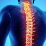 How To Prevent Spinal Cord Injuries